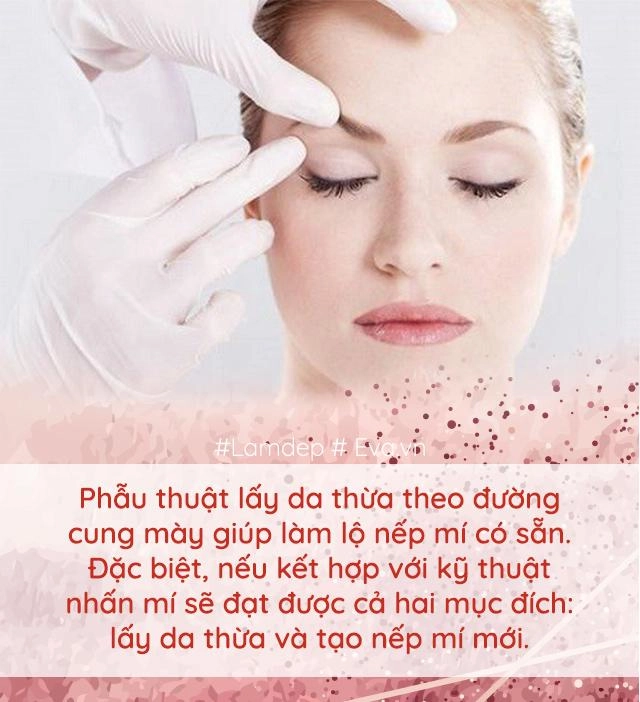 Làm đẹp thế nào khi cứ mãi lẫn lộn nhấn mí với cắt mí đây là điều bạn cần biết
