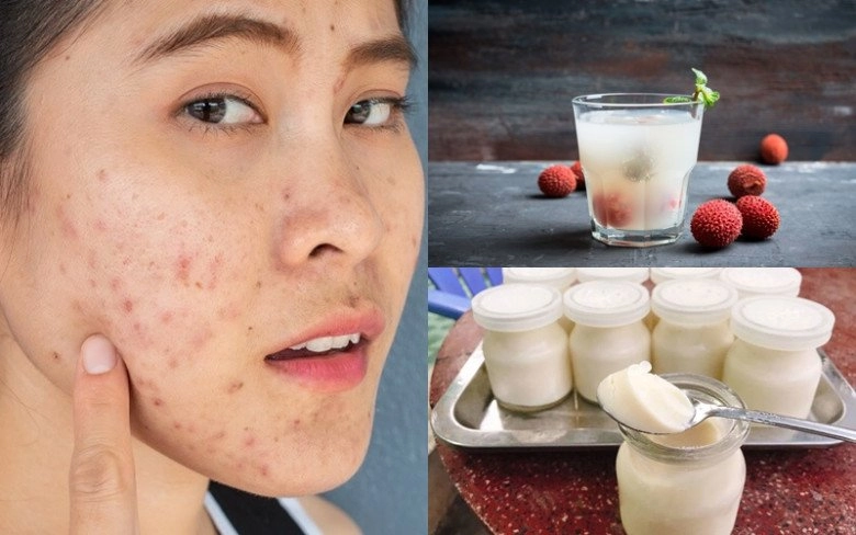 Loại quả việt đang vào mùa là thần dược dưỡng nhan chống lão hóa giúp mỹ nhân xưa khiến vua mê mệt