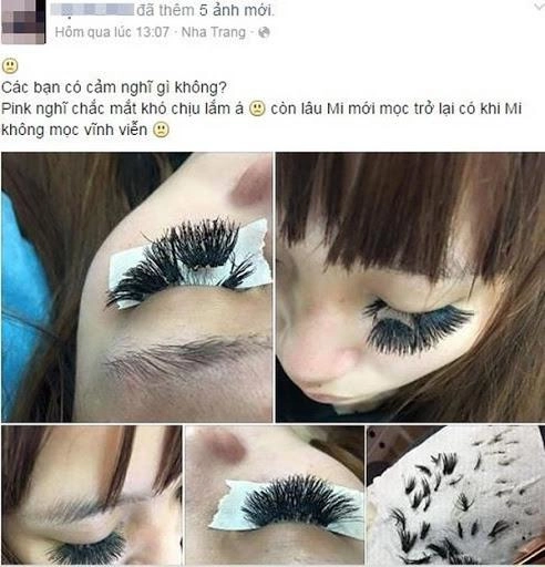 Loạt ảnh rợn cả người khiến chị em rùng mình xem xong còn ai dám đi nối mi