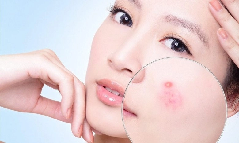 Nên hay không đắp mặt nạ dưỡng da từ sữa tươi không đường câu trả lời khiến chị em vỡ lẽ