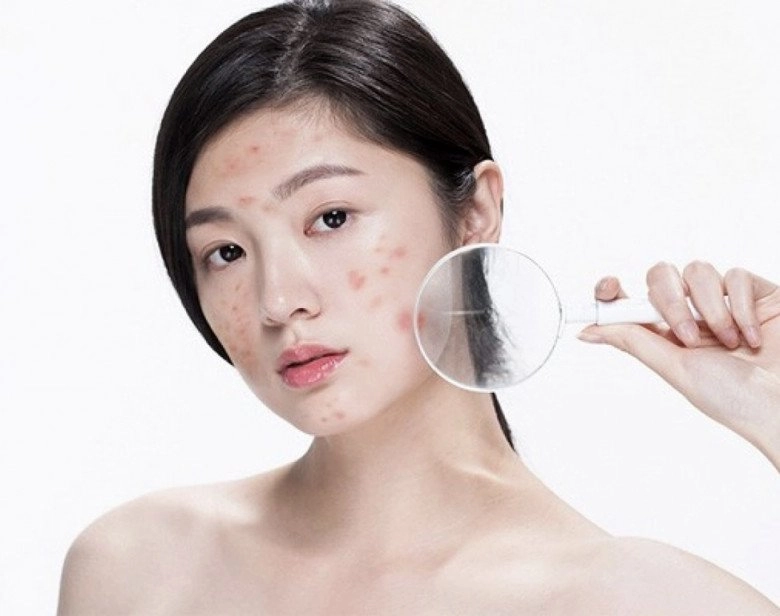 Nên hay không đắp mặt nạ dưỡng da từ sữa tươi không đường câu trả lời khiến chị em vỡ lẽ