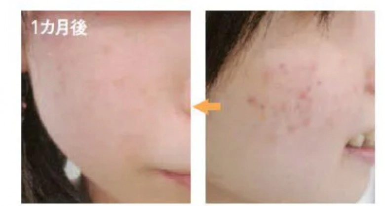 Người phụ nữ u60 trẻ như gái 18 nhờ phương pháp rửa mặt độc đáo dùng một loại gia vị trong bếp