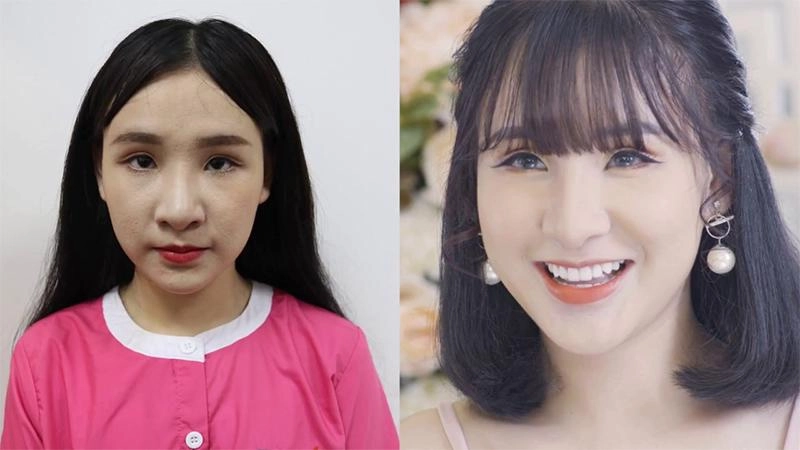 Phẫu thuật thẩm mỹ và những điều cần biết để tránh trở thành thảm họa