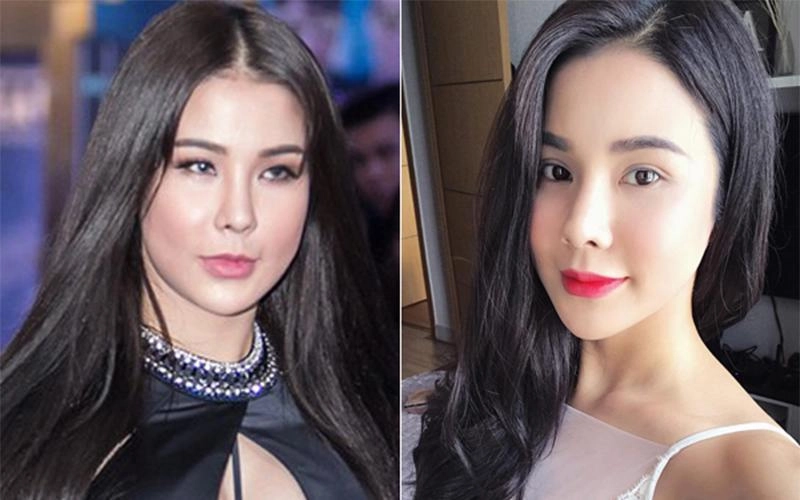 Phẫu thuật thẩm mỹ và những điều cần biết để tránh trở thành thảm họa