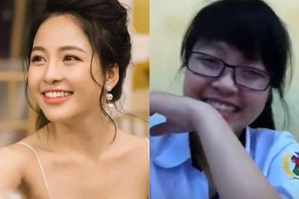 Phẫu thuật thẩm mỹ và những điều cần biết để tránh trở thành thảm họa