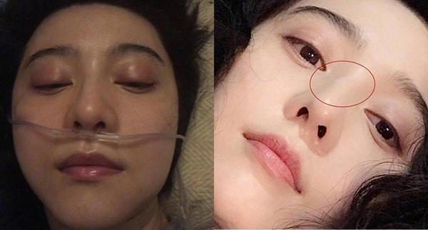Sau lùm xùm đời tư phạm băng băng xuất hiện với diện mạo khác lạ nghi dao kéo đổi vận