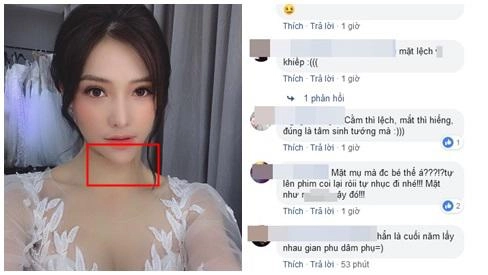 Sau ồn ào văng tục tại tòa lưu đê ly tiếp tục lộ cằm nhọn lệch hẳn sang một bên