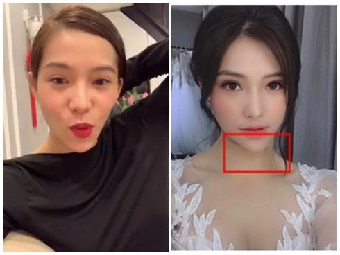 Sau ồn ào văng tục tại tòa lưu đê ly tiếp tục lộ cằm nhọn lệch hẳn sang một bên