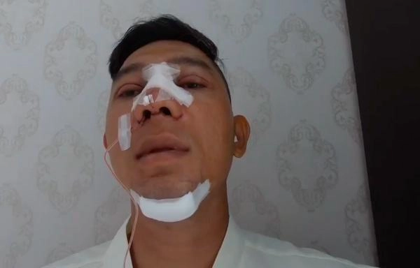 Selfie bên bạn trai với khuôn mặt băng bó chằng chịt ngân 98 cũng mới lên đời nhan sắc