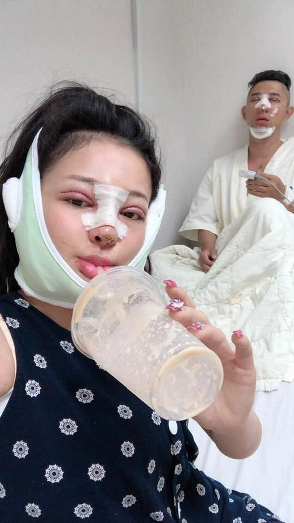 Selfie bên bạn trai với khuôn mặt băng bó chằng chịt ngân 98 cũng mới lên đời nhan sắc