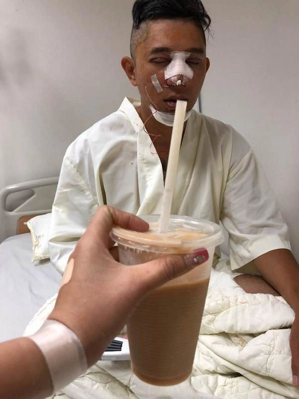 Selfie bên bạn trai với khuôn mặt băng bó chằng chịt ngân 98 cũng mới lên đời nhan sắc