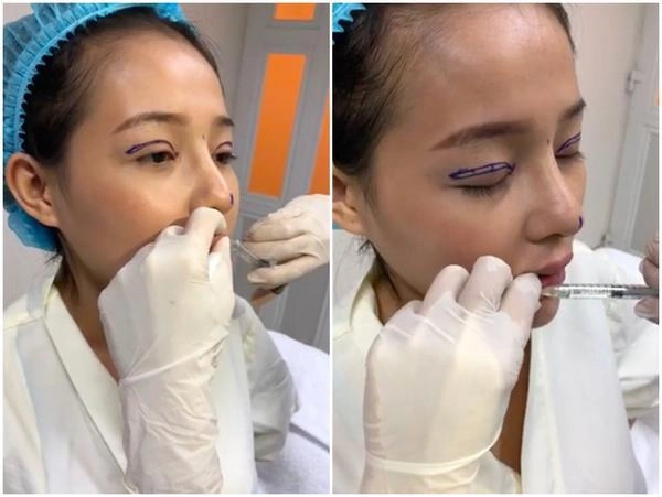 Selfie bên bạn trai với khuôn mặt băng bó chằng chịt ngân 98 cũng mới lên đời nhan sắc