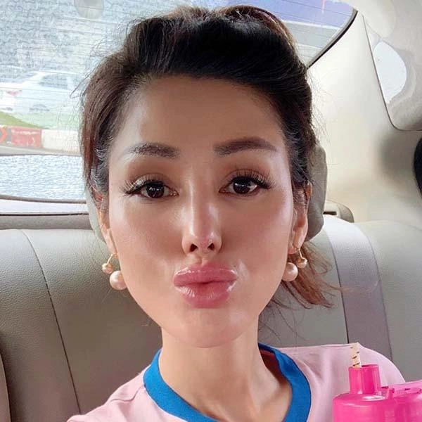 Sốc với khuôn mặt sau dao kéo của tình cũ ông chủ hãng hàng không tư nhân vn đầu tiên