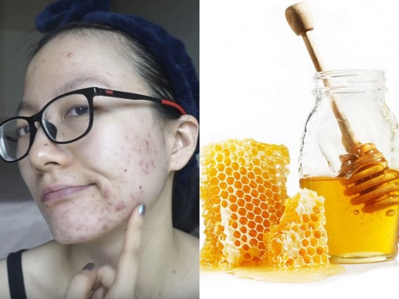 Sự khác biệt giữa uống mật ong và đắp lên mặt cách nào giúp da dẻ láng mịn trắng sáng không tì vết