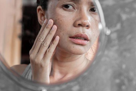 Sự khác biệt khi chăm sóc da thời kỳ mãn kinh bổ sung nhanh 2 thành phần chống lão hóa này