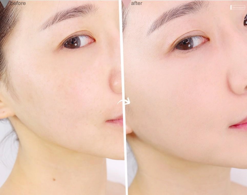 Thời tiết 40-45 độ 4 món mỹ phẩm này cô gái nào cũng phải có nếu không muốn thành than