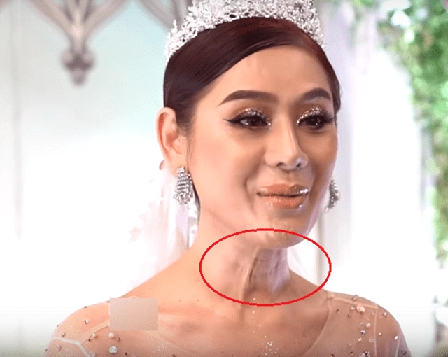 Vừa vướng nghi vấn phẫu thuật thẩm mỹ lâm khánh chi lại xuất hiện với vẻ ngoài khác lạ