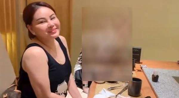 Xuất hiện với môi sưng khác lạ lê giang bị trấn thành bóng gió chuyện dao kéo