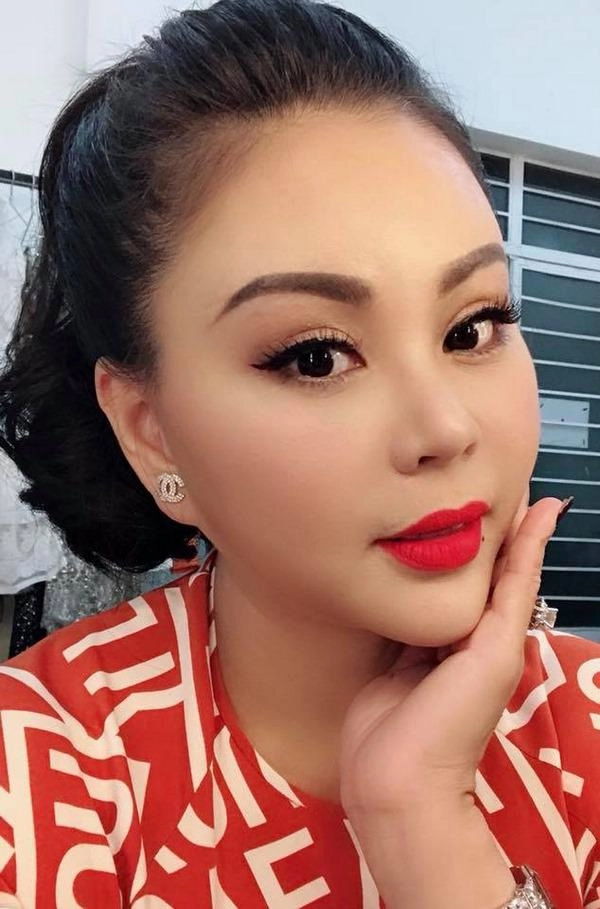 Xuất hiện với môi sưng khác lạ lê giang bị trấn thành bóng gió chuyện dao kéo