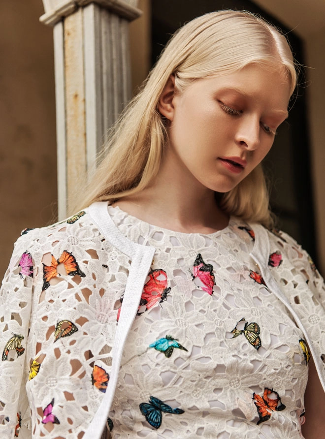 Người mẫu bạch tạng nổi tiếng ở mỹ sang việt nam