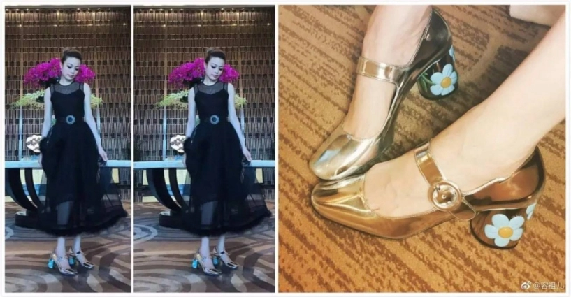 Siêu sao hoa ngữ biến dạng bàn chân vì sở thích đi giày cao gót quái chiêu