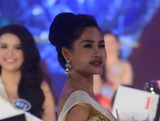 Thừa nhận phẫu thuật nâng mũi tân hoa hậu đại dương vẫn bị chê xấu