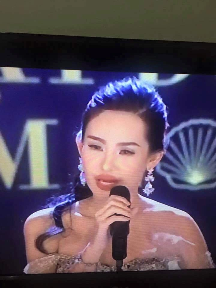 Thừa nhận phẫu thuật nâng mũi tân hoa hậu đại dương vẫn bị chê xấu