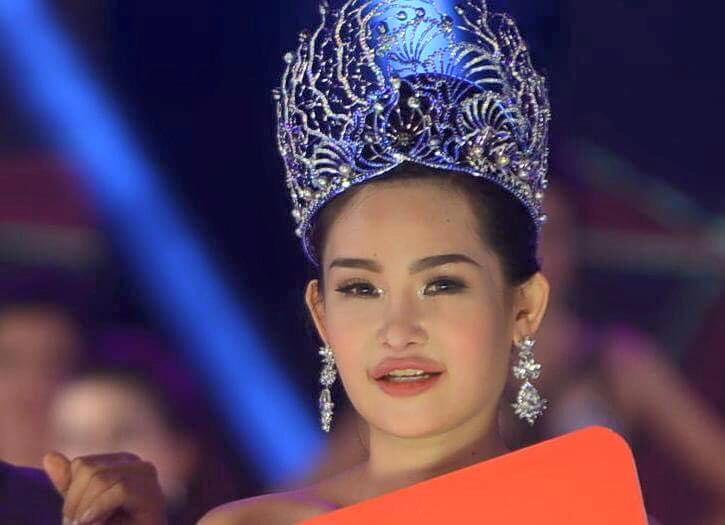 Thừa nhận phẫu thuật nâng mũi tân hoa hậu đại dương vẫn bị chê xấu